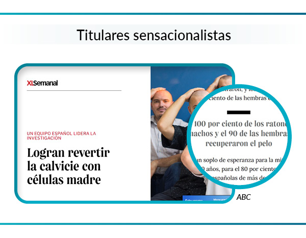 Titular de prensa sobre descubrimiento de tratamiento contra la calvice